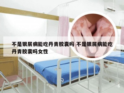 不是银屑病能吃丹青胶囊吗 不是银屑病能吃丹青胶囊吗女性