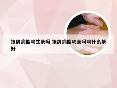 银屑病能喝生茶吗 银屑病能喝茶吗喝什么茶好