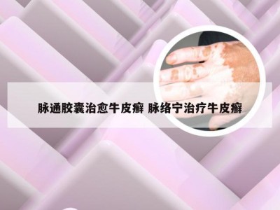 脉通胶囊治愈牛皮癣 脉络宁治疗牛皮癣