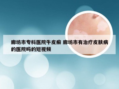 廊坊市专科医院牛皮癣 廊坊市有治疗皮肤病的医院吗的短视频