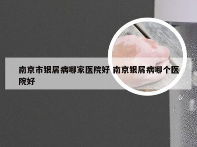 南京市银屑病哪家医院好 南京银屑病哪个医院好