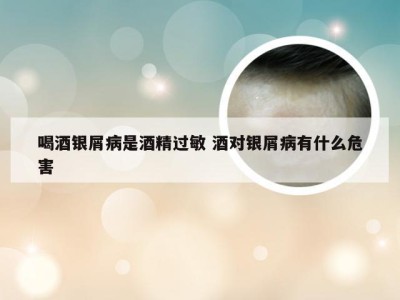 喝酒银屑病是酒精过敏 酒对银屑病有什么危害