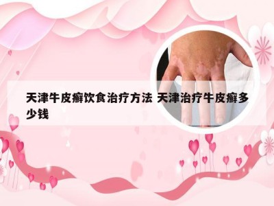 天津牛皮癣饮食治疗方法 天津治疗牛皮癣多少钱
