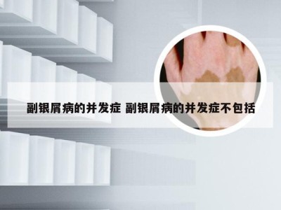 副银屑病的并发症 副银屑病的并发症不包括