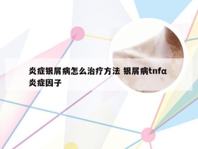 炎症银屑病怎么治疗方法 银屑病tnfα 炎症因子