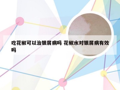 吃花椒可以治银屑病吗 花椒水对银屑病有效吗