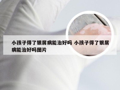 小孩子得了银屑病能治好吗 小孩子得了银屑病能治好吗图片