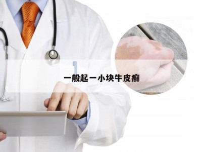 一般起一小块牛皮癣