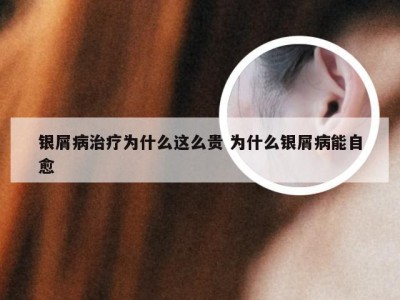 银屑病治疗为什么这么贵 为什么银屑病能自愈