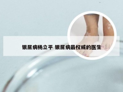 银屑病杨立平 银屑病最权威的医生