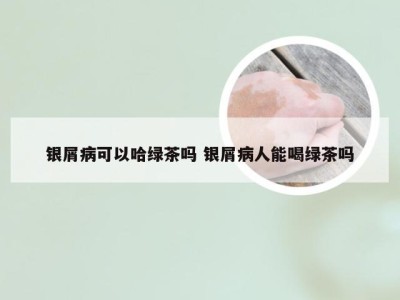 银屑病可以哈绿茶吗 银屑病人能喝绿茶吗