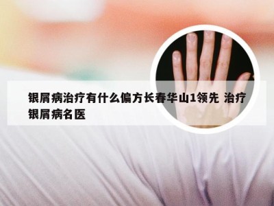 银屑病治疗有什么偏方长春华山1领先 治疗银屑病名医