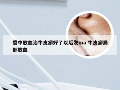 委中放血治牛皮癣好了以后发ma 牛皮癣局部放血