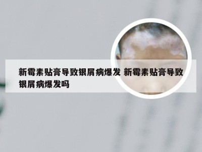 新霉素贴膏导致银屑病爆发 新霉素贴膏导致银屑病爆发吗