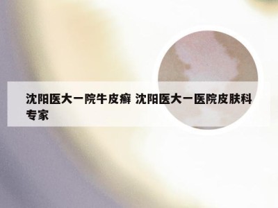 沈阳医大一院牛皮癣 沈阳医大一医院皮肤科专家