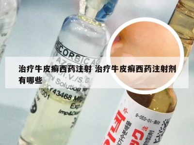 治疗牛皮癣西药注射 治疗牛皮癣西药注射剂有哪些