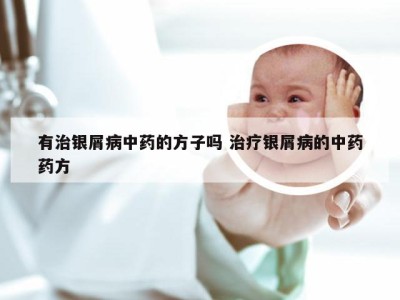 有治银屑病中药的方子吗 治疗银屑病的中药药方