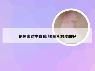 褪黑素对牛皮癣 褪黑素对皮肤好