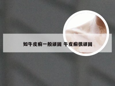 如牛皮癣一般顽固 牛皮癣很顽固
