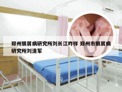 郑州银屑病研究所刘长江咋样 郑州市银屑病研究所刘清军