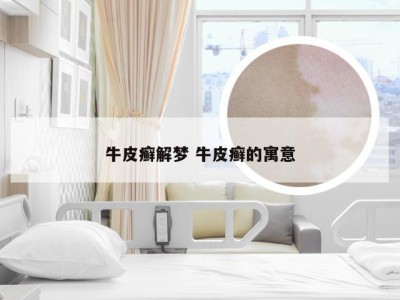 牛皮癣解梦 牛皮癣的寓意