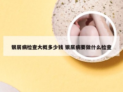 银屑病检查大概多少钱 银屑病要做什么检查