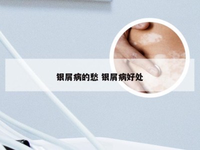 银屑病的愁 银屑病好处