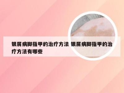 银屑病脚指甲的治疗方法 银屑病脚指甲的治疗方法有哪些