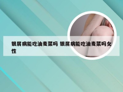 银屑病能吃油麦菜吗 银屑病能吃油麦菜吗女性