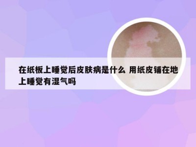 在纸板上睡觉后皮肤病是什么 用纸皮铺在地上睡觉有湿气吗