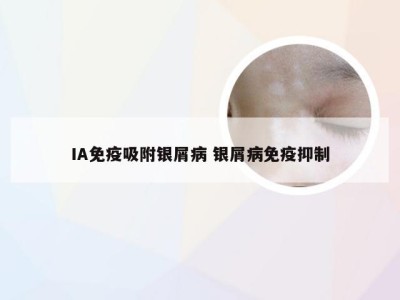 IA免疫吸附银屑病 银屑病免疫抑制
