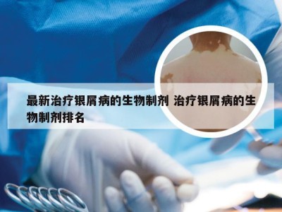 最新治疗银屑病的生物制剂 治疗银屑病的生物制剂排名
