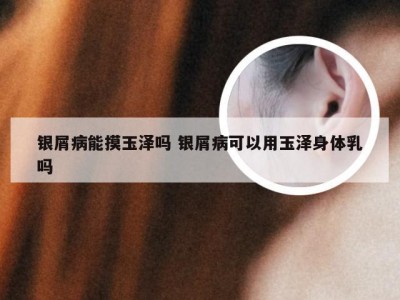 银屑病能摸玉泽吗 银屑病可以用玉泽身体乳吗