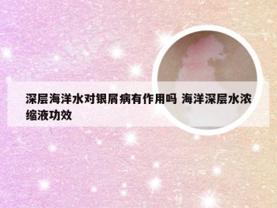 深层海洋水对银屑病有作用吗 海洋深层水浓缩液功效