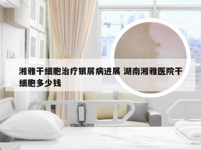 湘雅干细胞治疗银屑病进展 湖南湘雅医院干细胞多少钱
