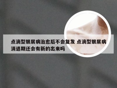 点滴型银屑病治愈后不会复发 点滴型银屑病消退期还会有新的出来吗