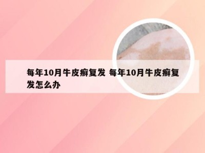 每年10月牛皮癣复发 每年10月牛皮癣复发怎么办
