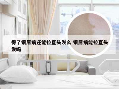 得了银屑病还能拉直头发么 银屑病能拉直头发吗