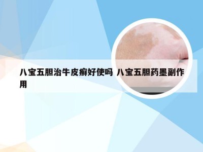 八宝五胆治牛皮癣好使吗 八宝五胆药墨副作用