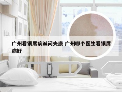 广州看银屑病诚问夫康 广州哪个医生看银屑病好
