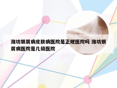 潍坊银屑病皮肤病医院是正规医院吗 潍坊银屑病医院是几级医院