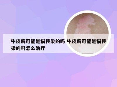 牛皮癣可能是猫传染的吗 牛皮癣可能是猫传染的吗怎么治疗