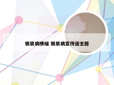 银屑病横幅 银屑病宣传语主题