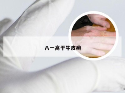八一高干牛皮癣