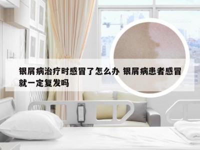 银屑病治疗时感冒了怎么办 银屑病患者感冒就一定复发吗