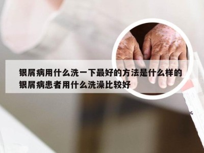 银屑病用什么洗一下最好的方法是什么样的 银屑病患者用什么洗澡比较好