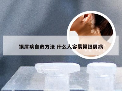 银屑病自愈方法 什么人容易得银屑病