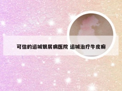 可信的运城银屑病医院 运城治疗牛皮癣