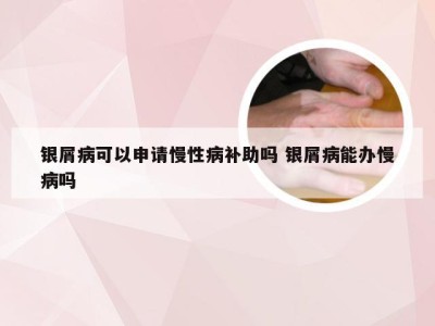 银屑病可以申请慢性病补助吗 银屑病能办慢病吗