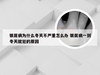 银屑病为什么冬天不严重怎么办 银屑病一到冬天就犯的原因
